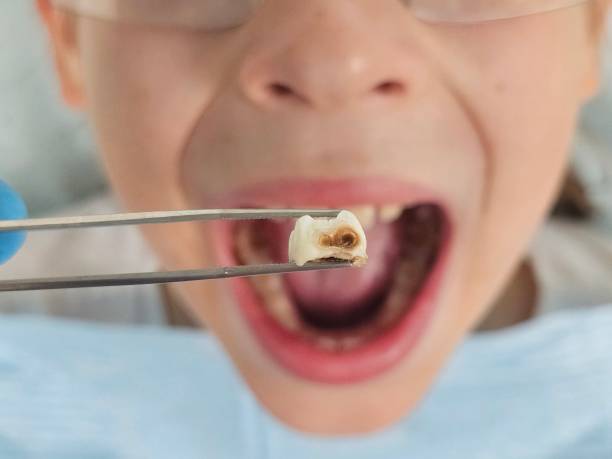 Best Weekend Emergency Dentist in Park View, IA